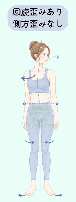 回旋歪みあり側方歪みなし