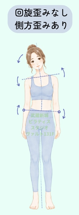 回旋歪みなし側方歪みあり