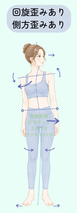 回旋歪みあり側方歪みあり