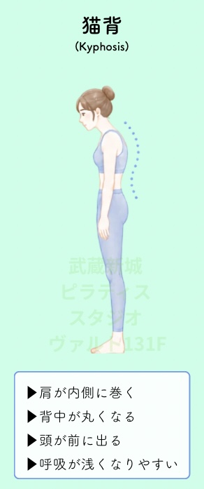猫背姿勢