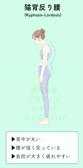 猫背反り腰姿勢
