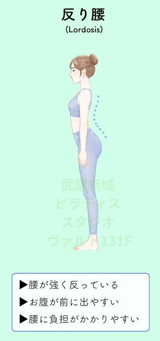 反り腰姿勢（lordosis）