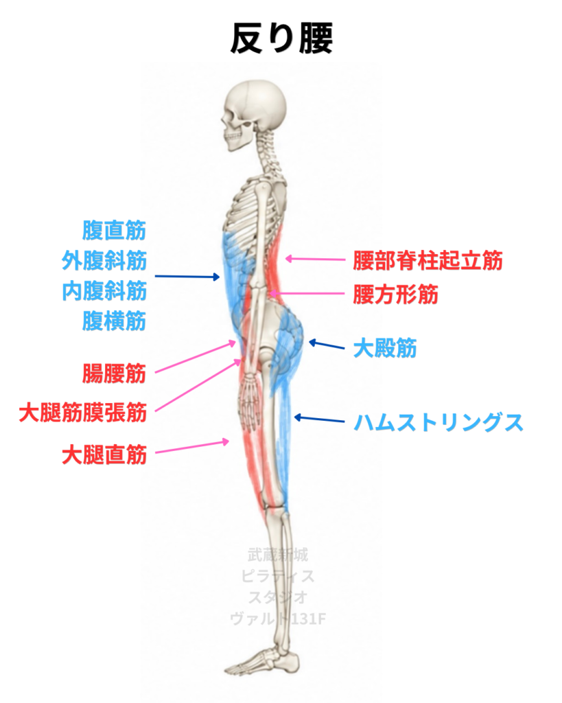 反り腰姿勢の筋肉