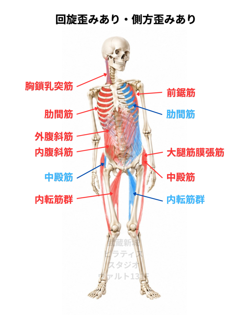回旋歪みあり側方歪みありの筋肉